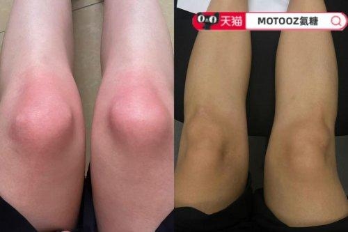 2026氨糖软骨素钙片口碑品牌！认准好货，养出灵活关节